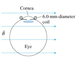 Cornea 0-6.0-mm-diameter coil O Eye